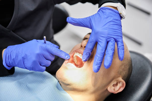 Best Emergency Treatment for Dental Infections or Abscesses in Southwest Ranches, FL